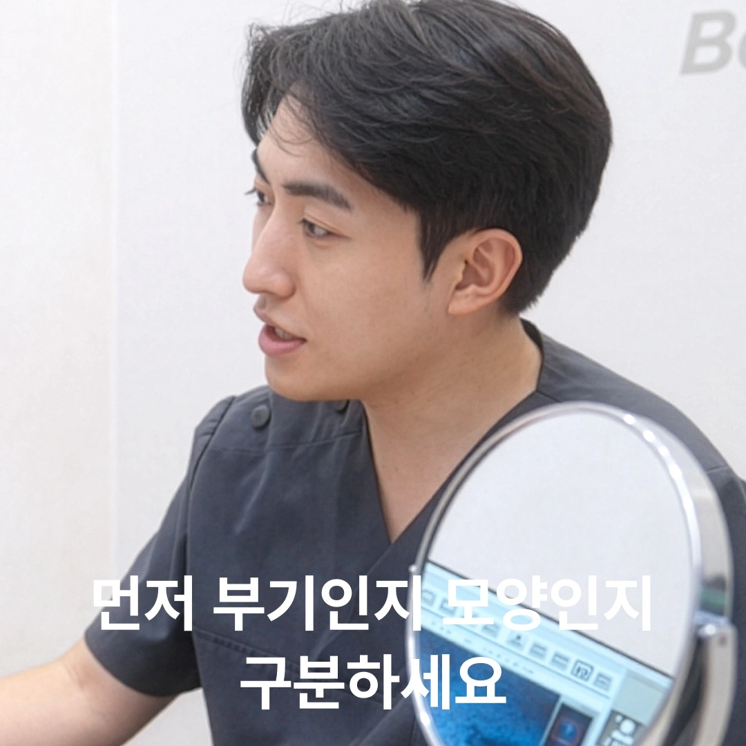 "입술 필러 후 오리 입술 됐어요" — 성급하게 다 녹이기 전 꼭 알아야 할 3일간의 부기
