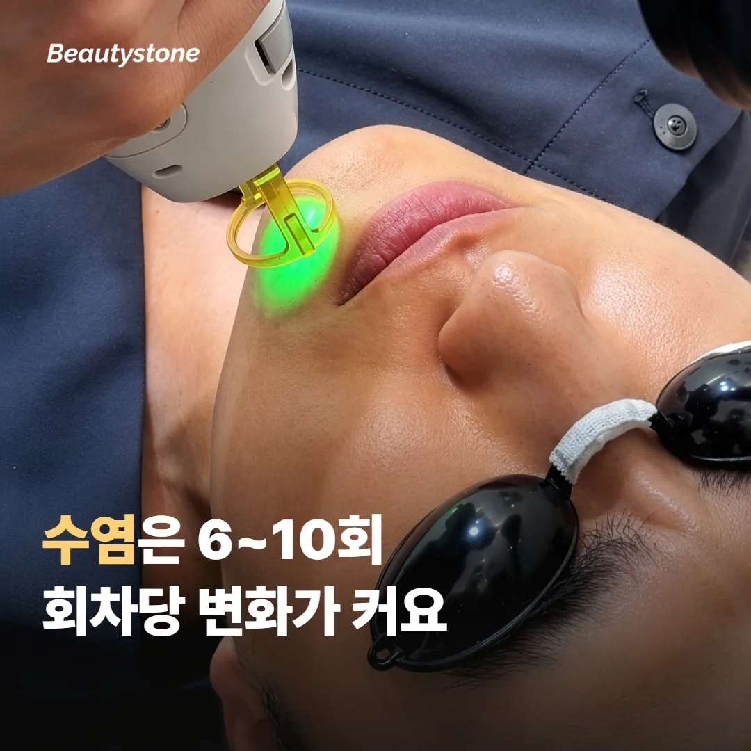 수염 제모는 회차당 변화가 크지만 횟수도 더 필요해요