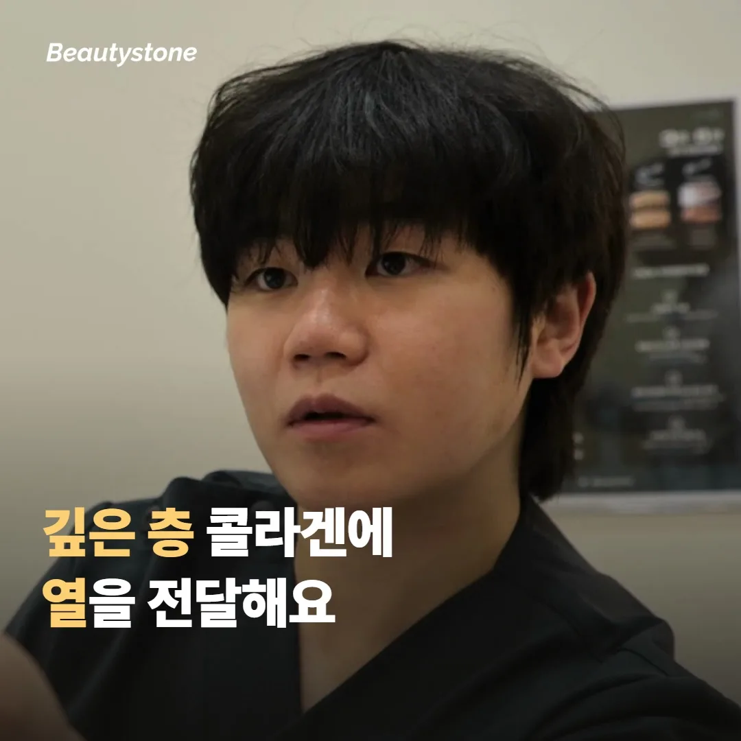 모노폴라 RF가 깊은 층에 열을 전달하는 방식