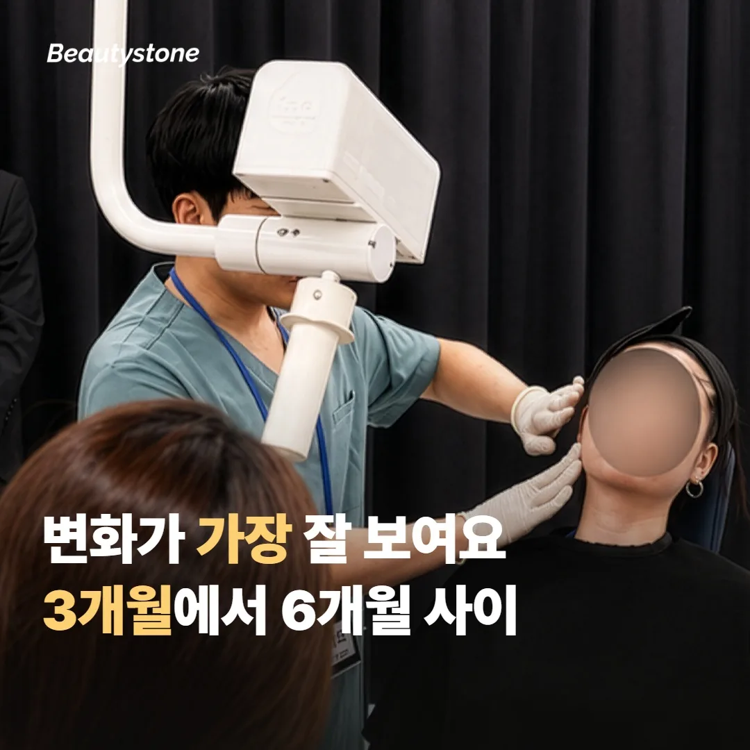 가장 두드러진 변화는 보통 3~6개월 사이에 보여요
