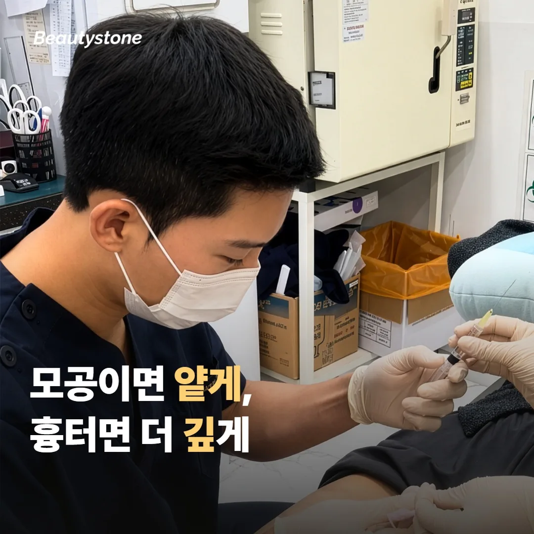 모공 고민이면 — 얕은 깊이 + 짧은 간격이 핵심이에요
