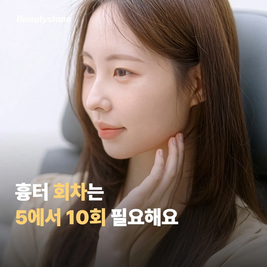 여드름 흉터가 주된 고민이면 — 깊은 깊이 + 충분한 회차가 필요해요