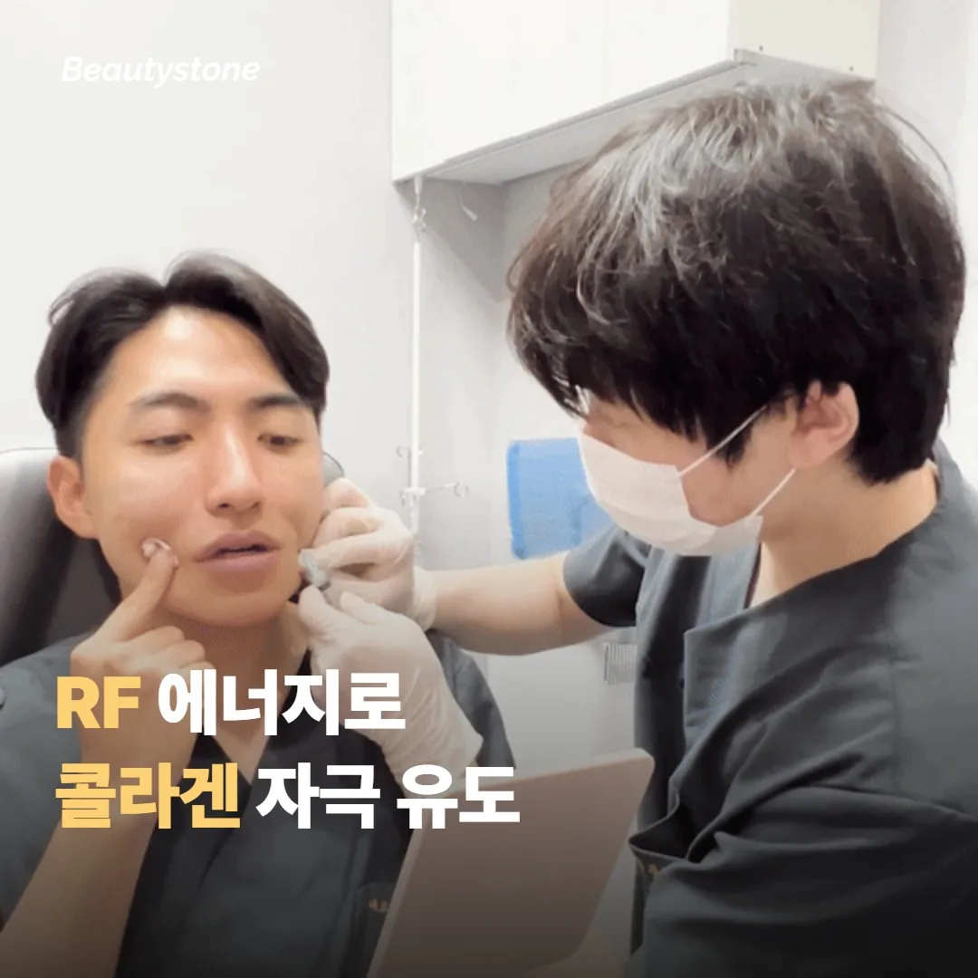 올타이트 RF 는 어떤 시술인가요
