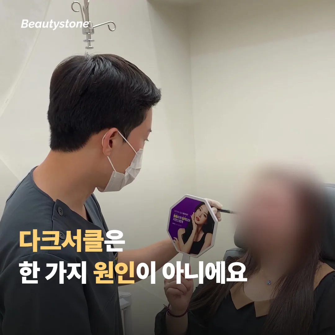 다크서클은 한 가지 원인이 아니에요
