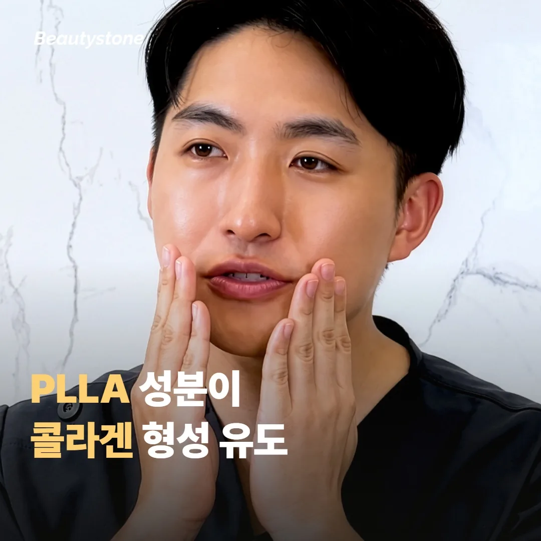 스컬트라가 다른 필러와 다른 점 — PLLA 콜라겐 자극 원리