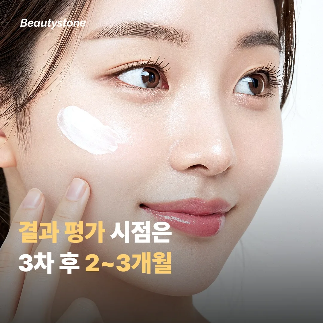 시술 간격과 결과를 좌우하는 요인