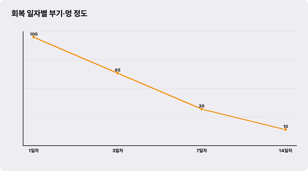 회복 일자별 부기·멍 정도