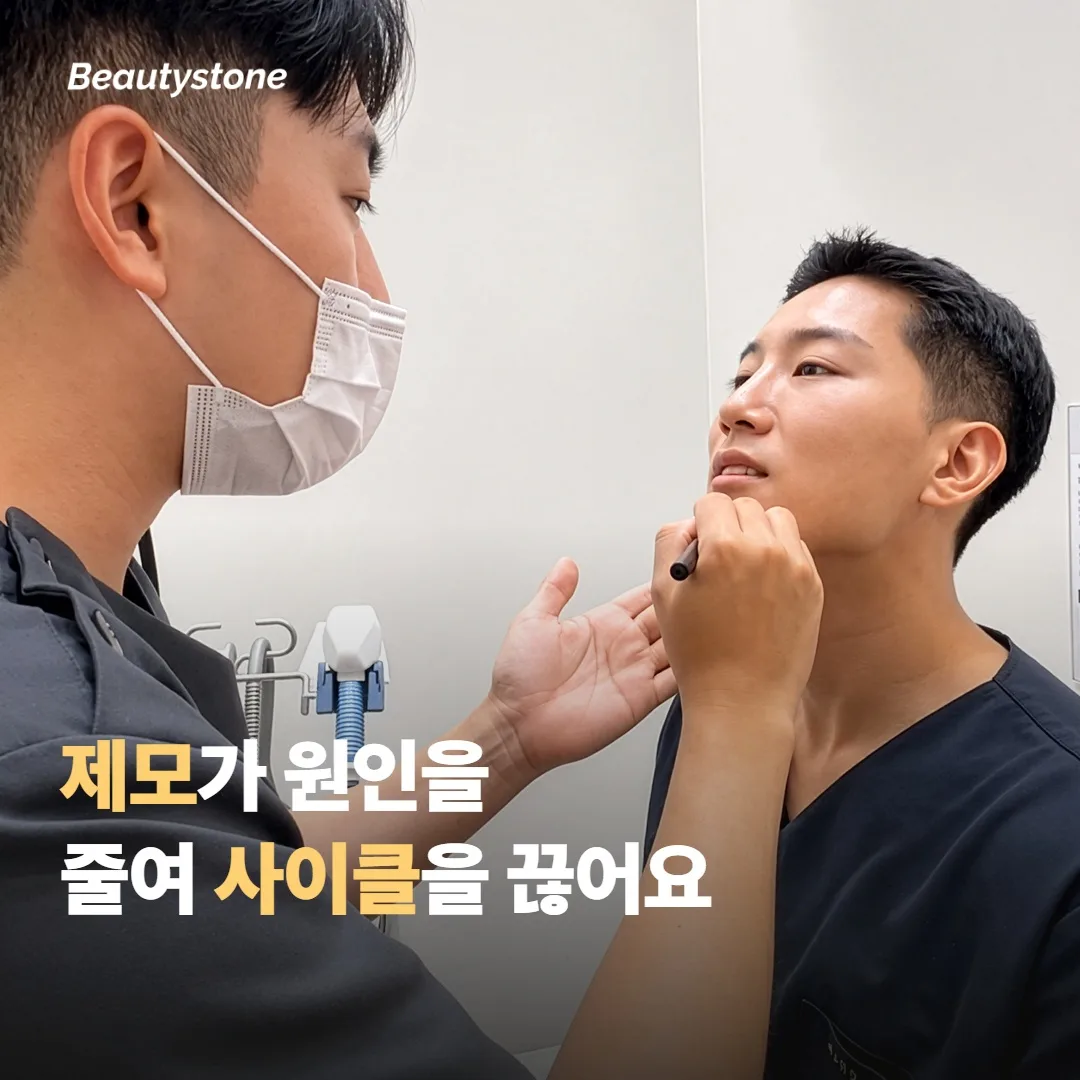 胡須脫毛如何切斷惡性循環