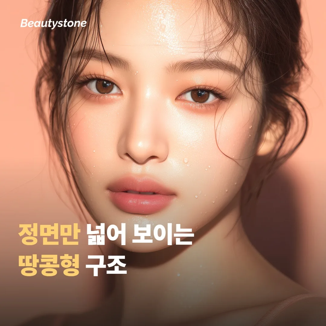 โครงสร้างที่ทำให้หน้าทรงถั่วลิสงดูเด่นชัด