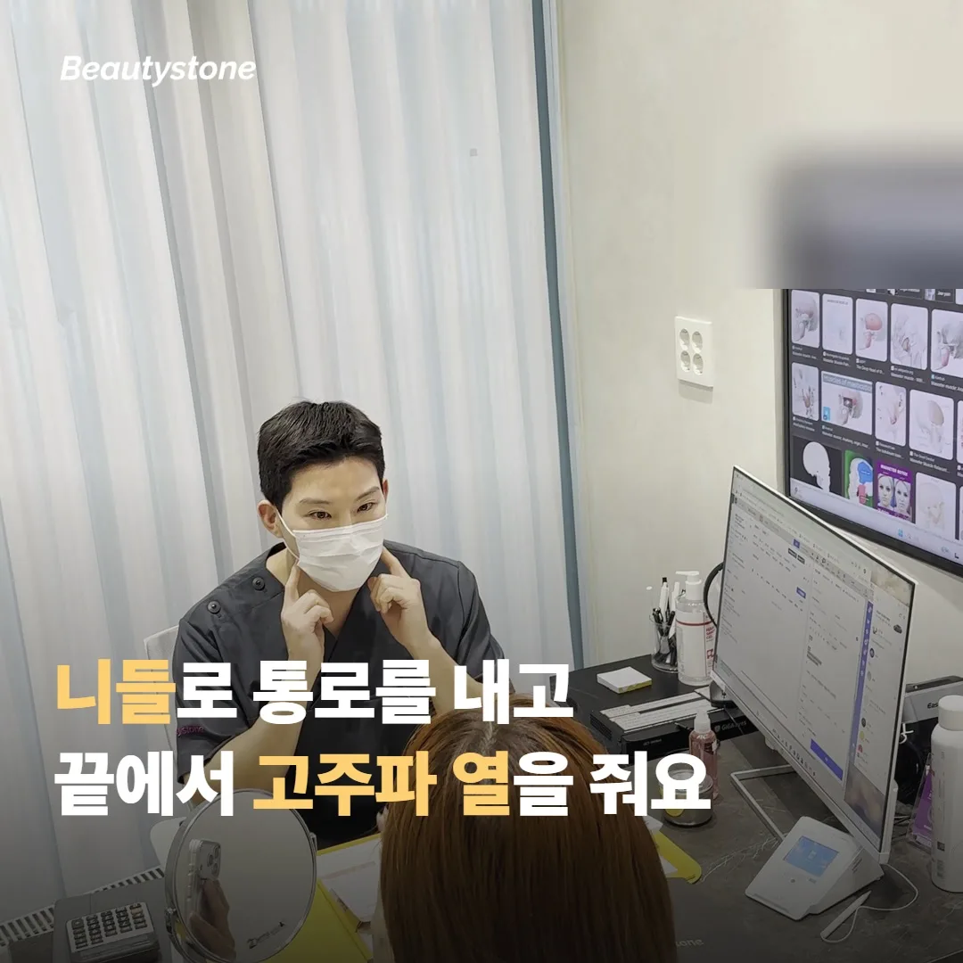 포텐자는 어떤 방식으로 작동하나요?