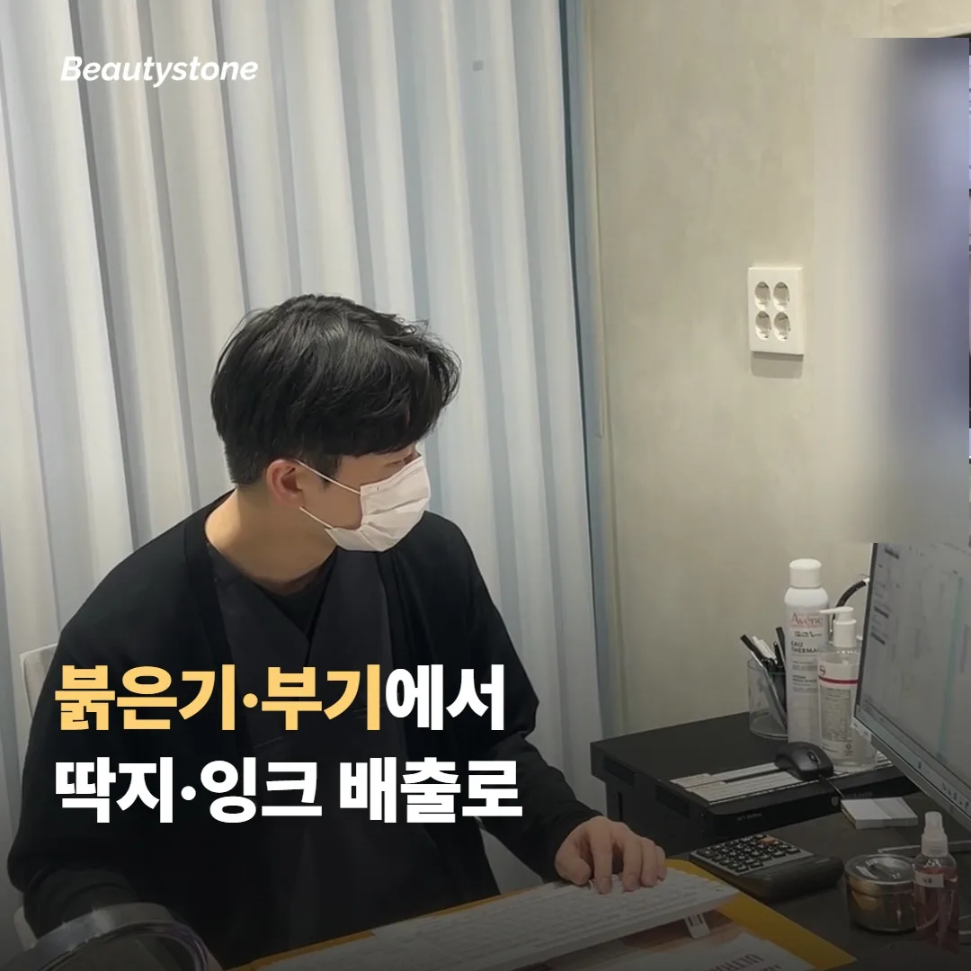 시술 직후부터 회복까지의 순서