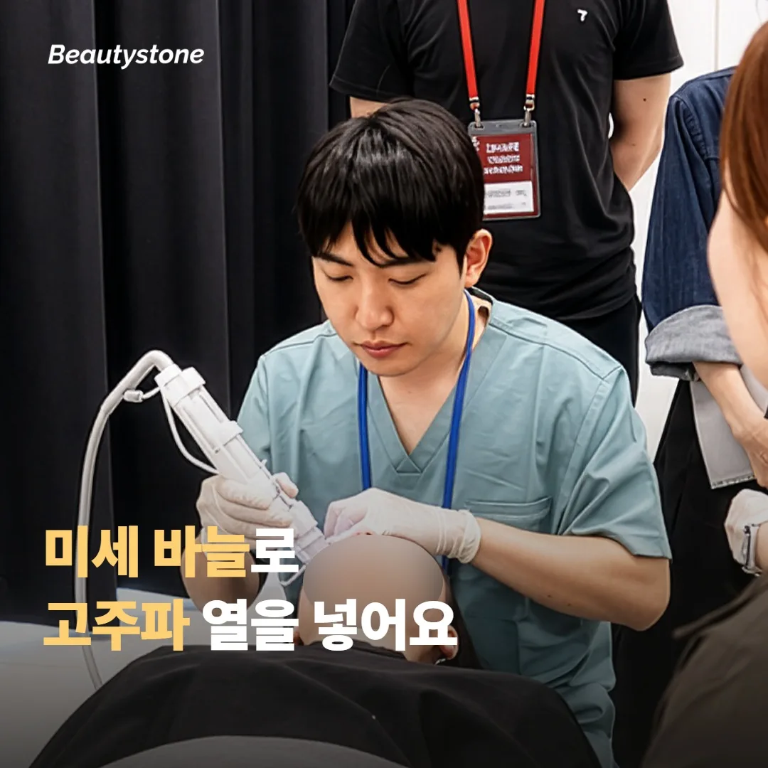 시크릿RF는 어떤 시술인가요?