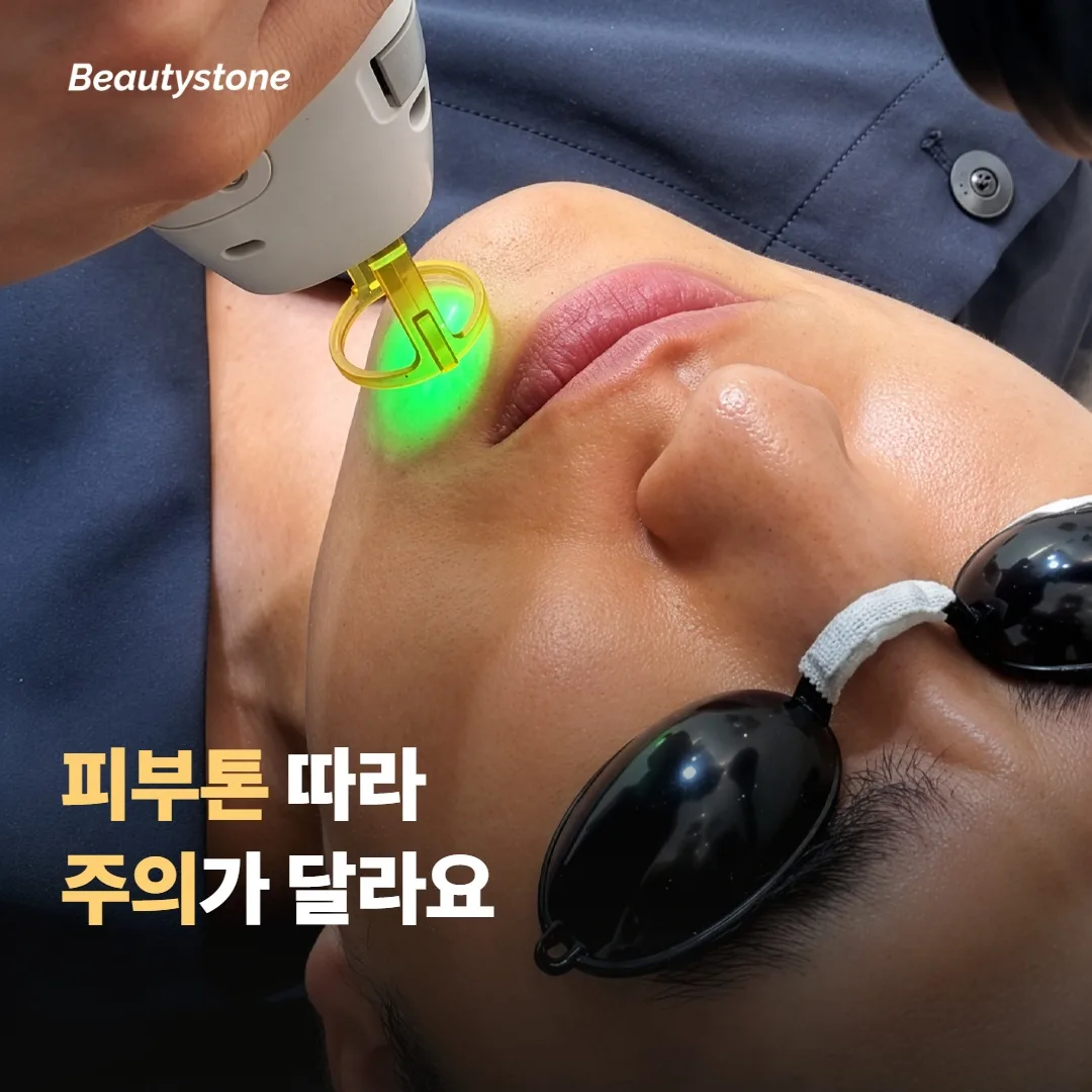 모든 피부톤에 다 되나요?
