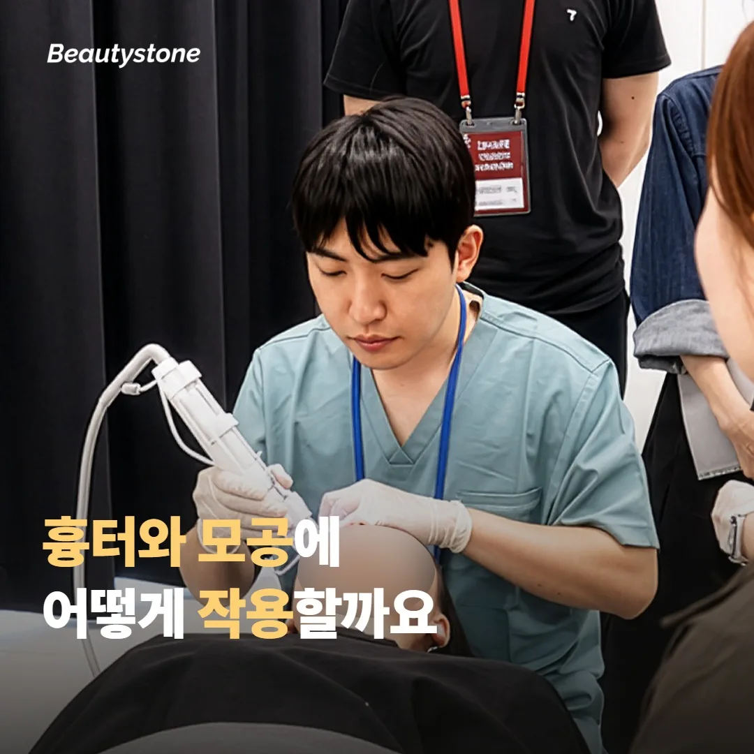 시크릿RF는 흉터와 모공에 어떻게 작용할까요