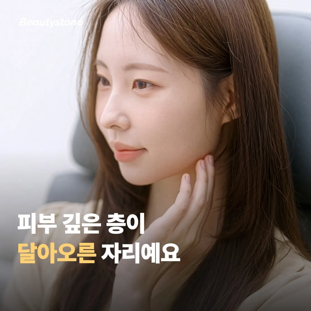 시술 직후, 피부 깊은 층이 달아오른 자리예요