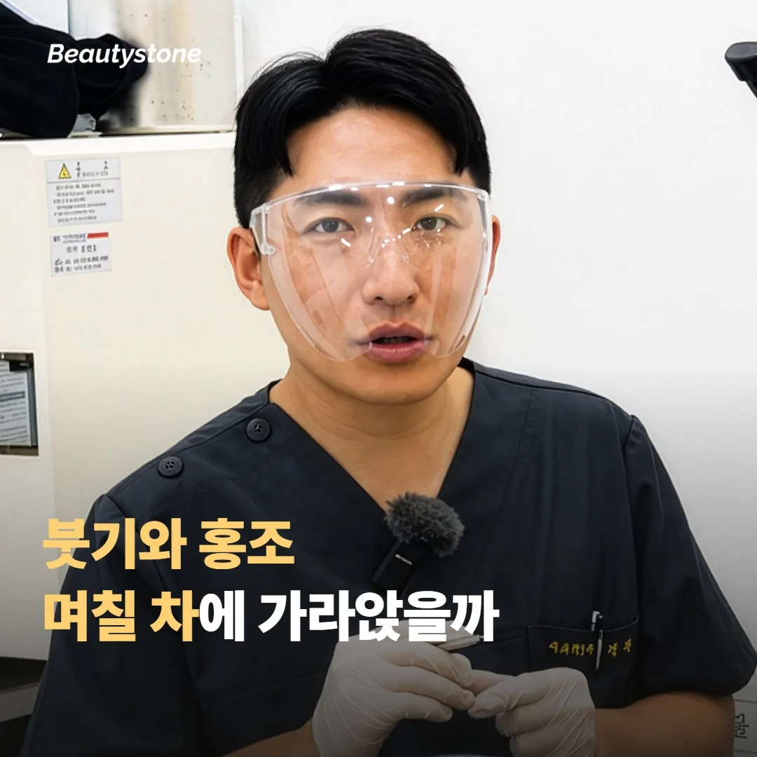 며칠 차에 가라앉을까요, 붓기와 홍조 회복 흐름