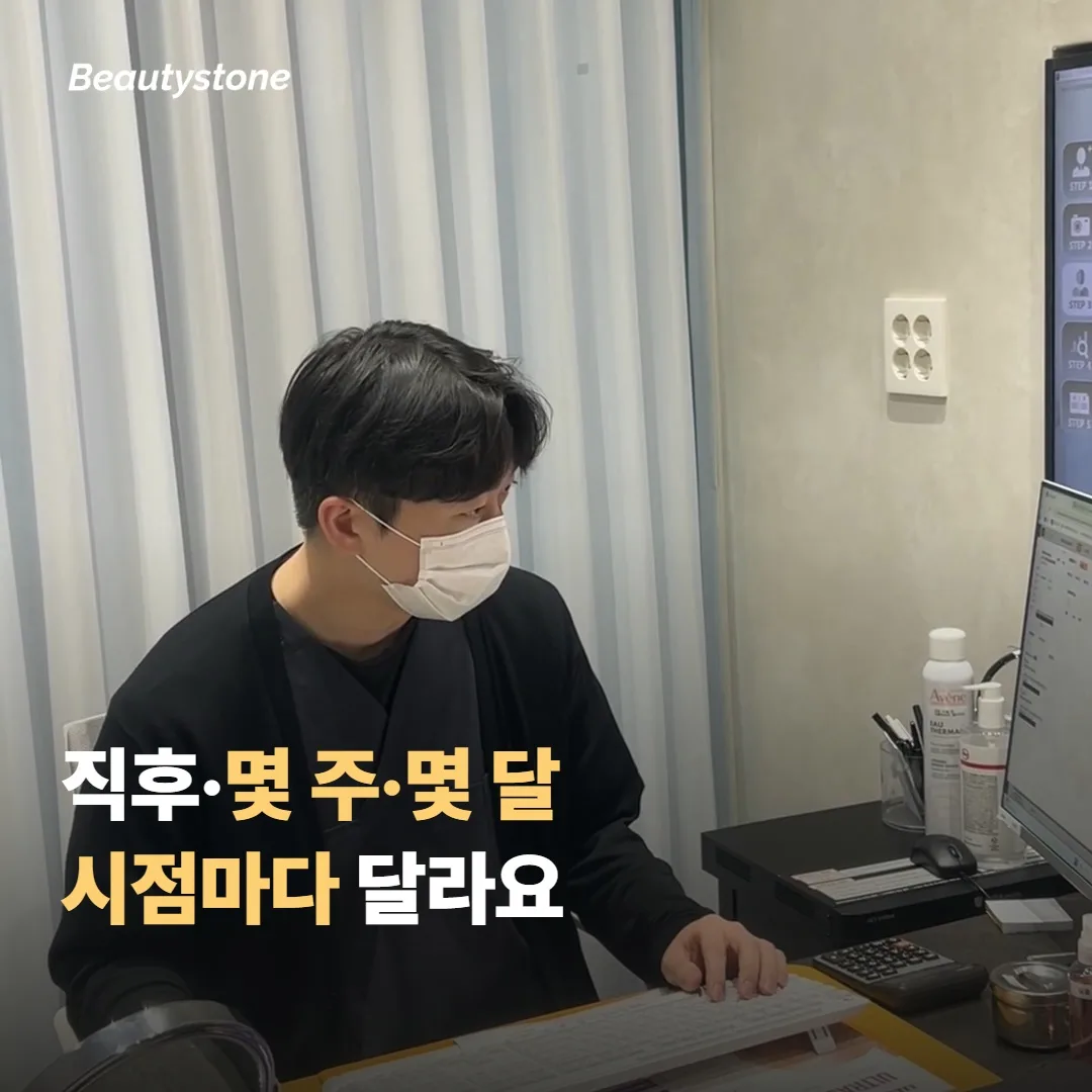 직후·몇 주·몇 달, 시점마다 체감이 달라요