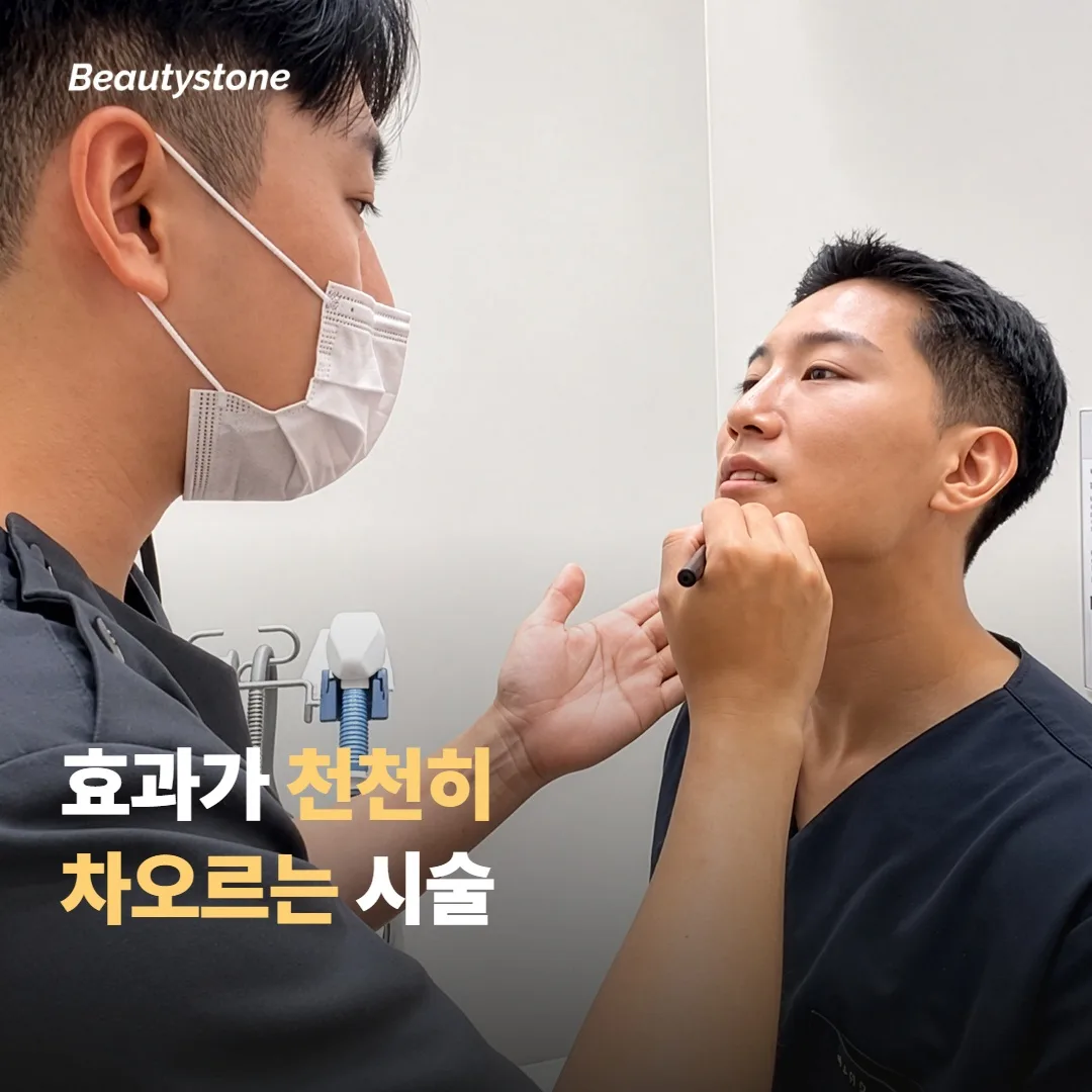 소프웨이브는 효과가 천천히 차오르는 시술이에요