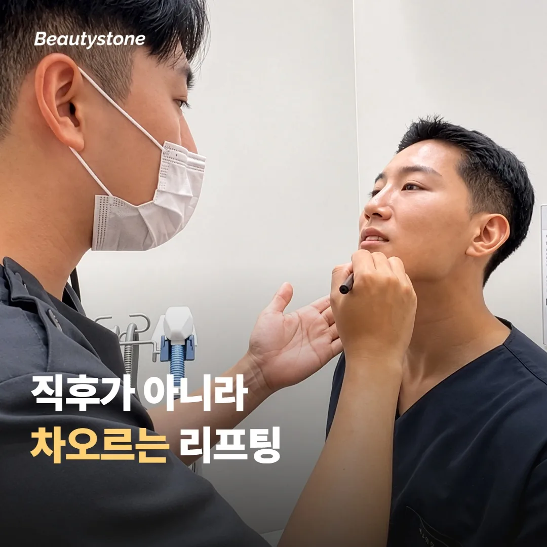 울쎄라 프라임은 직후가 아니라 시간을 두고 차오르는 리프팅이에요