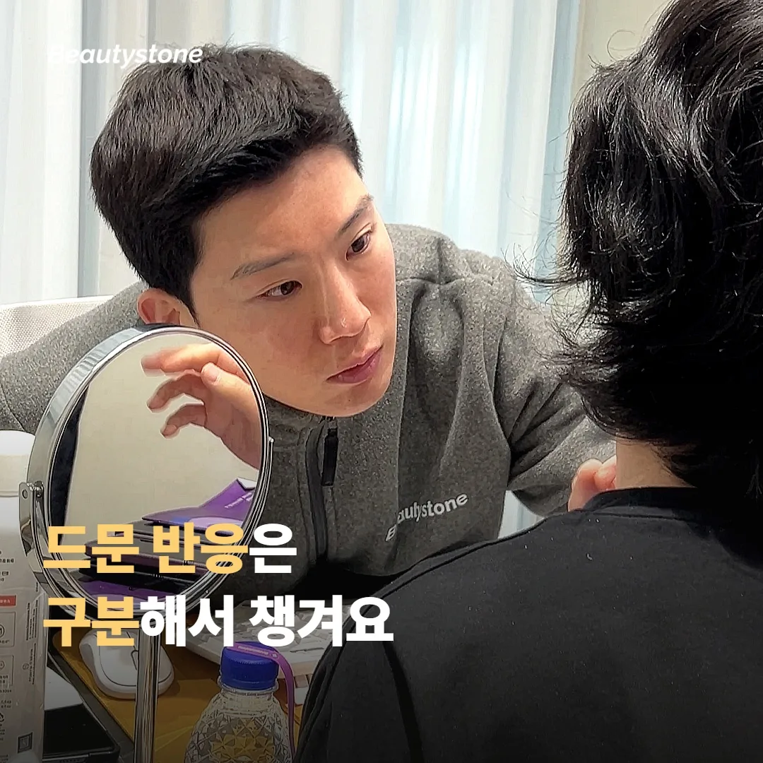 드물지만 주의해야 할 반응도 구분해 둘게요