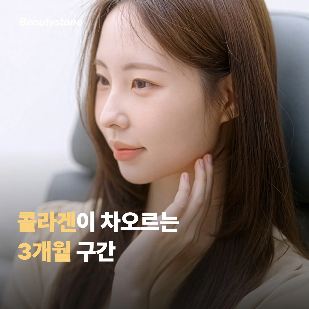 콜라겐이 다시 차오르는 3개월, 효과가 또렷해지는 구간이에요