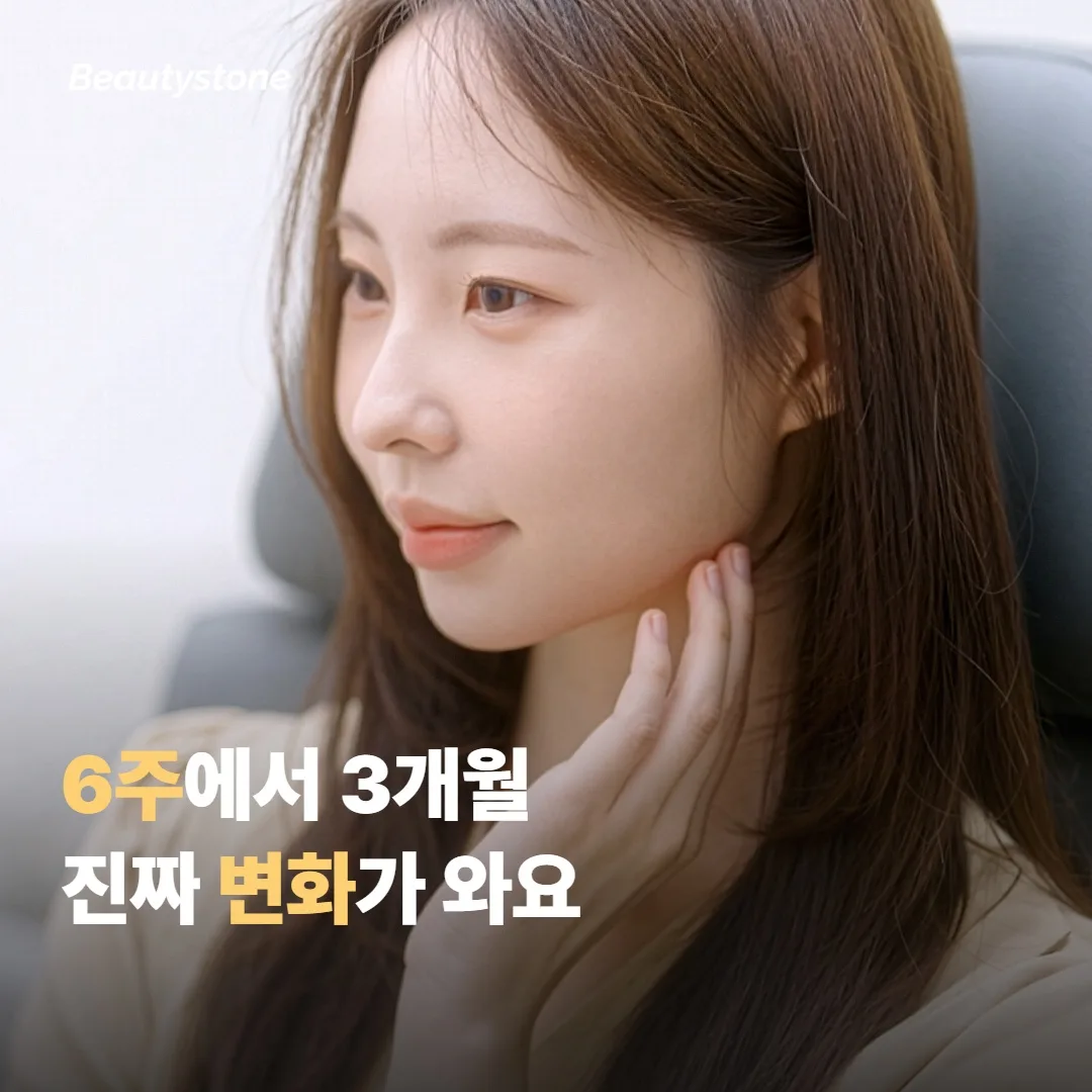 볼륨이 천천히 차오르는 6주에서 3개월, 진짜 변화가 오는 구간이에요