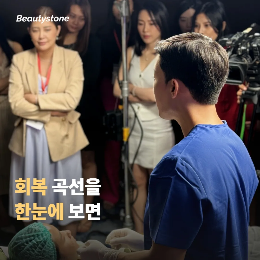 회복 곡선을 한눈에 보면 이래요