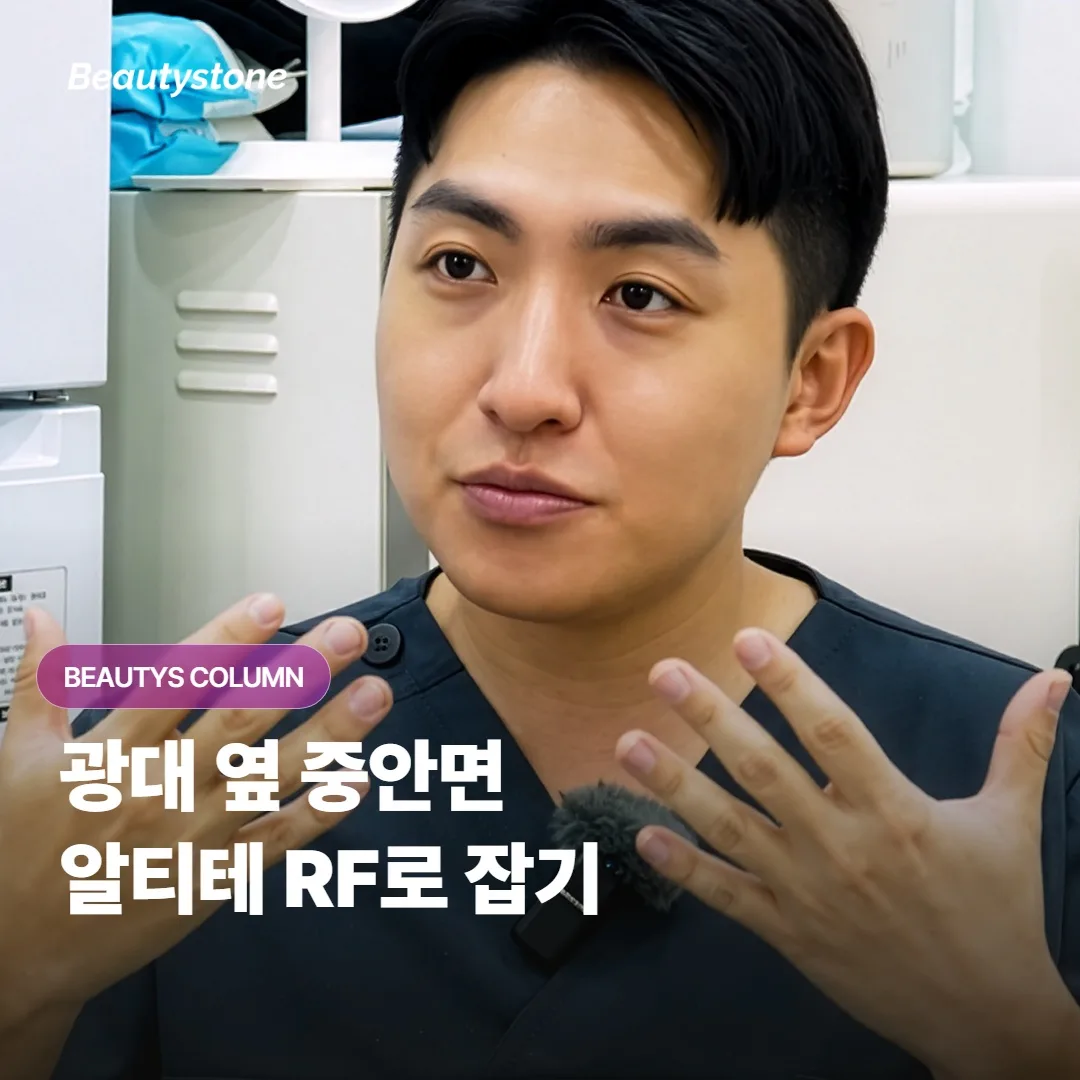 알티테 RF는 광대 옆으로 처지는 중안면 볼륨에 어떻게 작용하고 누구에게 잘 맞을까요?