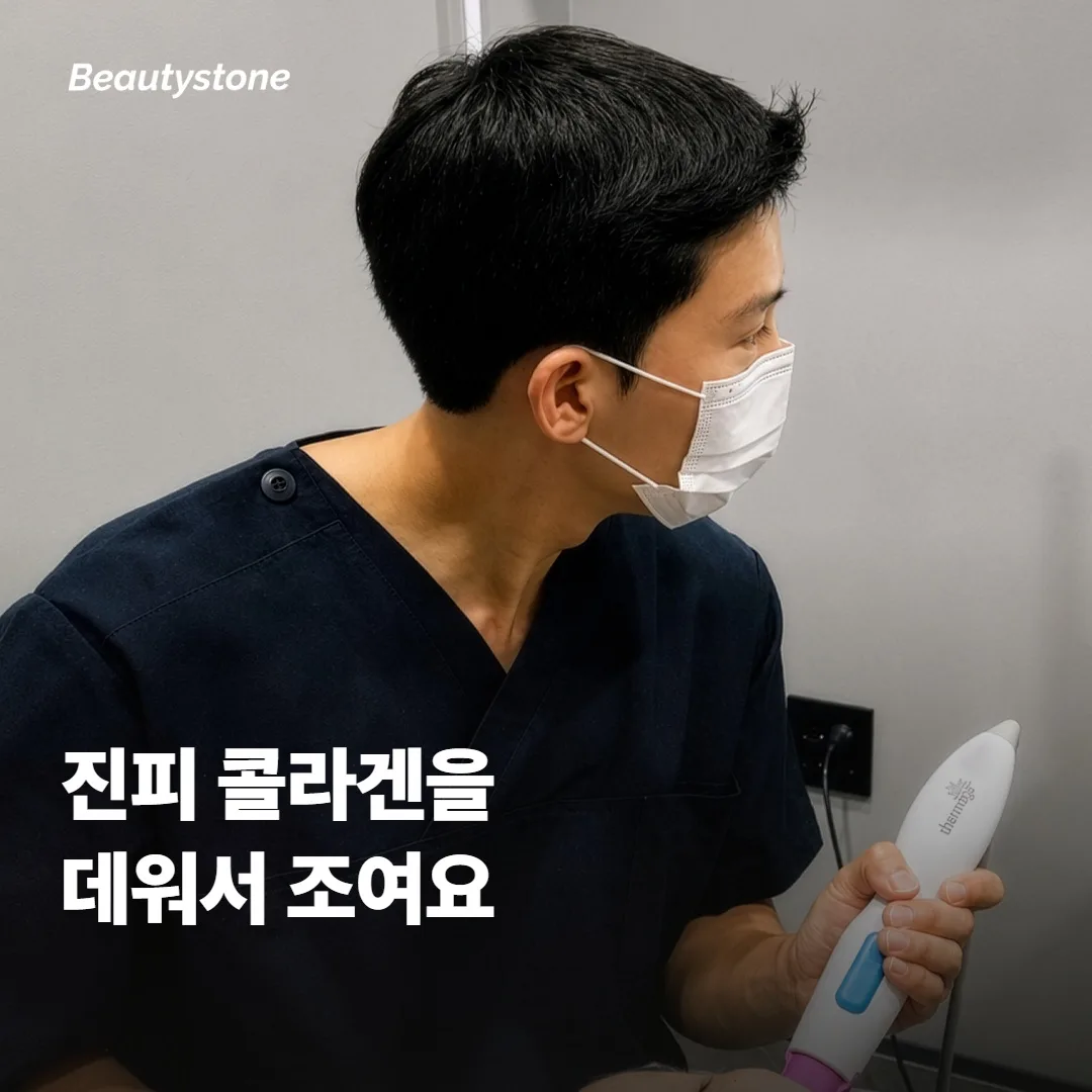 알티테 RF가 중안면 탄력을 잡아주는 원리