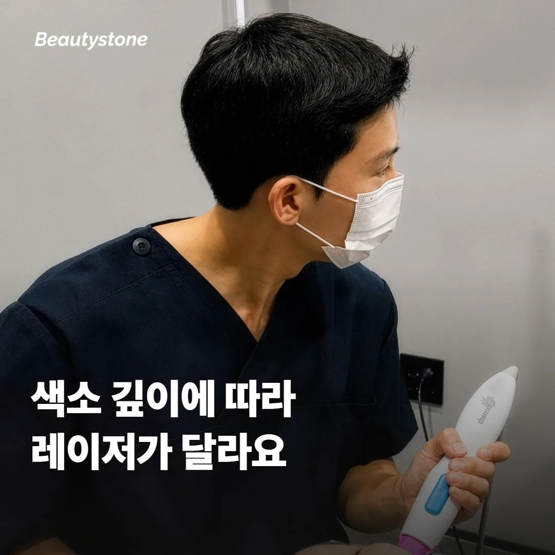 색소 깊이에 따라 레이저가 달라지는 이유