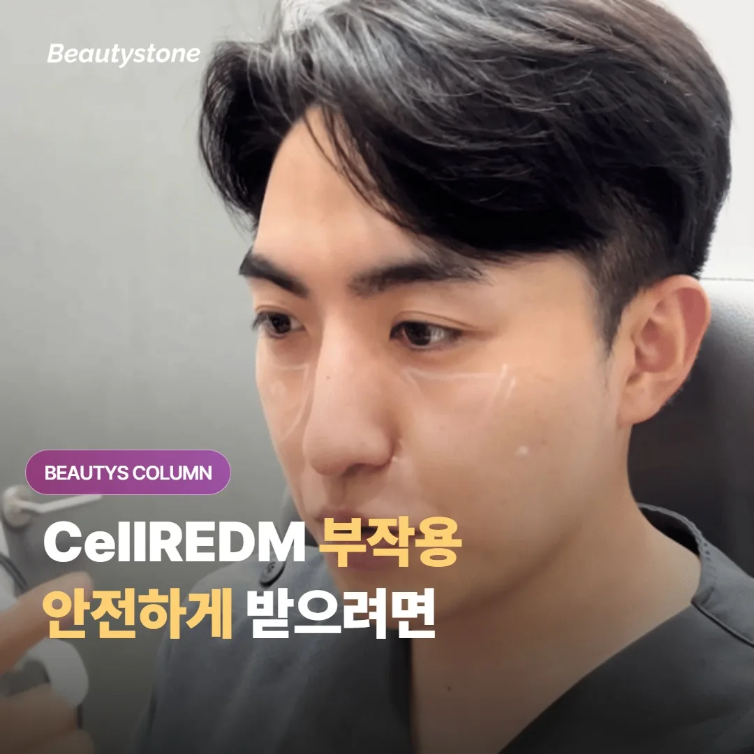 CellREDM 스킨부스터의 부작용으로는 무엇이 있고 어떻게 해야 안전하게 받을 수 있을까요?