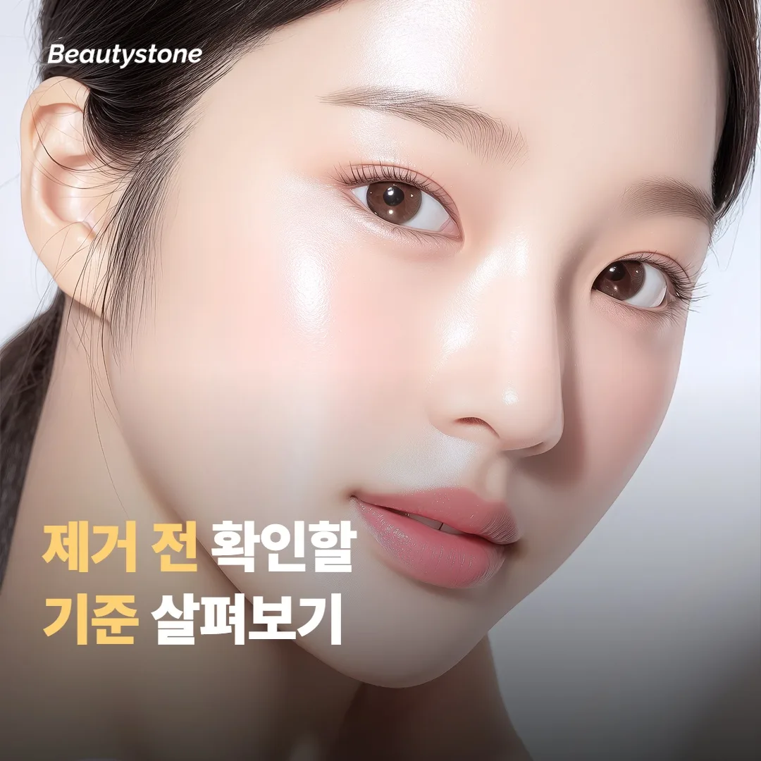 문신 제거 전 기준으로 확인하면 좋은 점