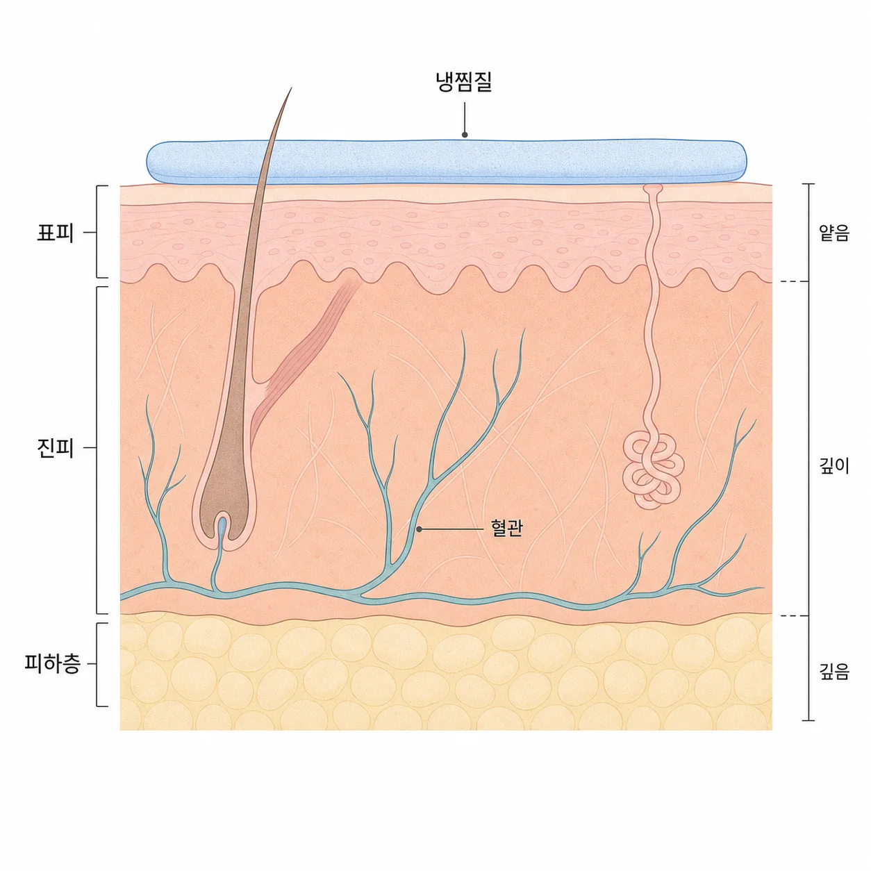 Illustration showing blood vessels narrowing in response to cold stimulation