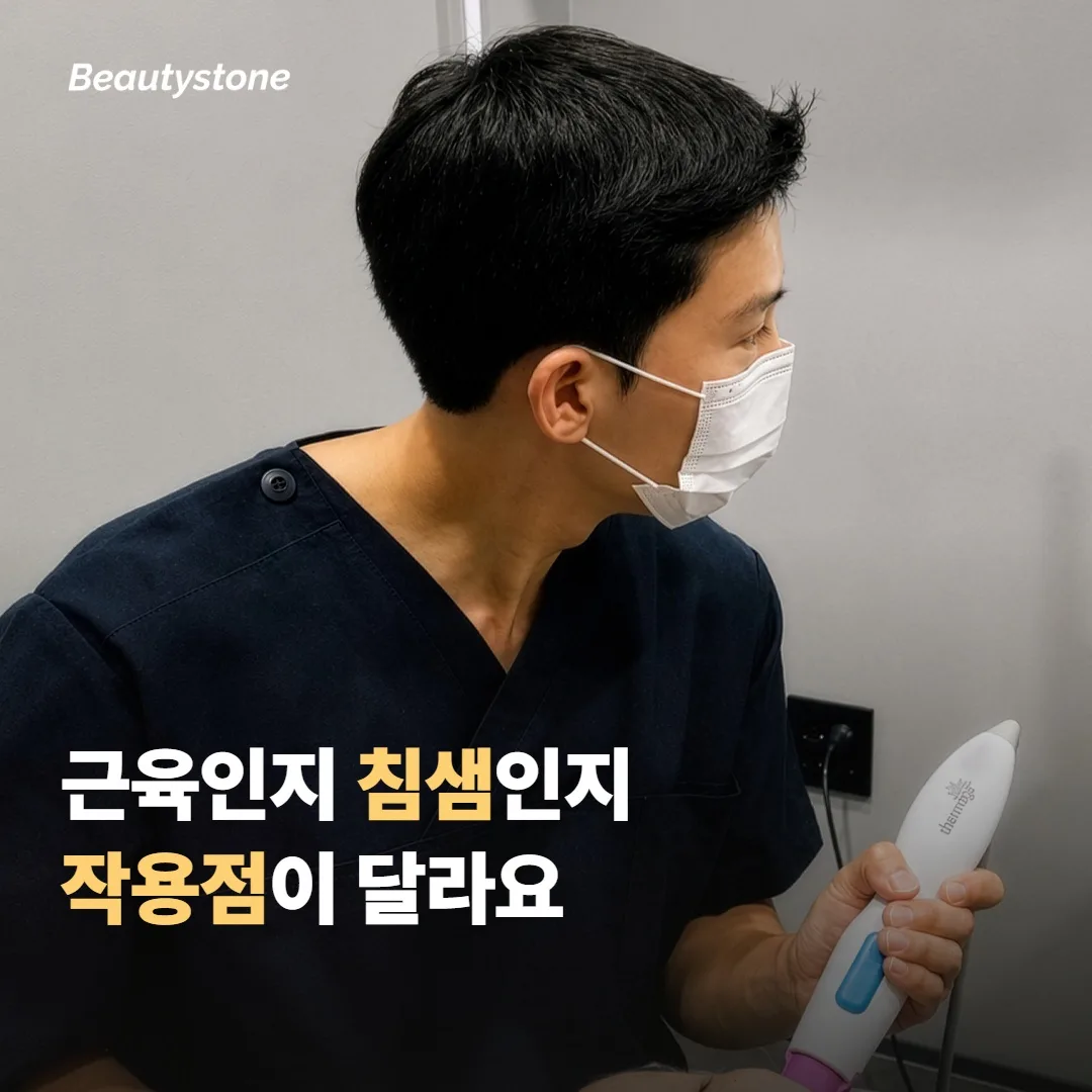 턱 보톡스와 귀밑샘 보톡스, 무엇이 다를까요