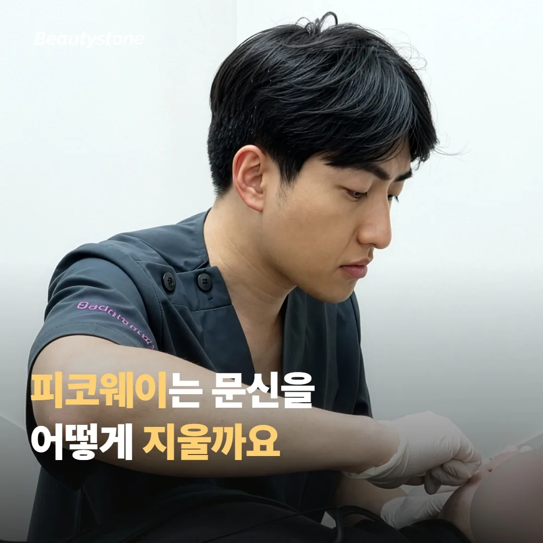 피코웨이는 문신을 어떻게 지우나요
