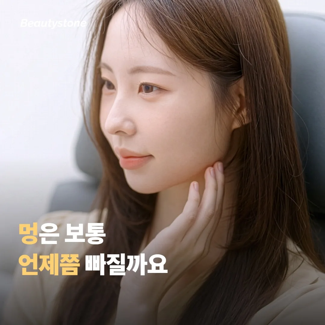 멍은 보통 언제쯤 빠지나요