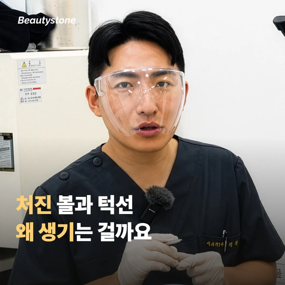 출산 후 처진 볼과 턱선, 왜 생기는 걸까요