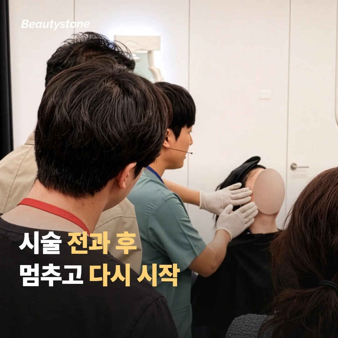 시술 전과 후, 멈추고 다시 시작하는 시점을 비교해볼게요