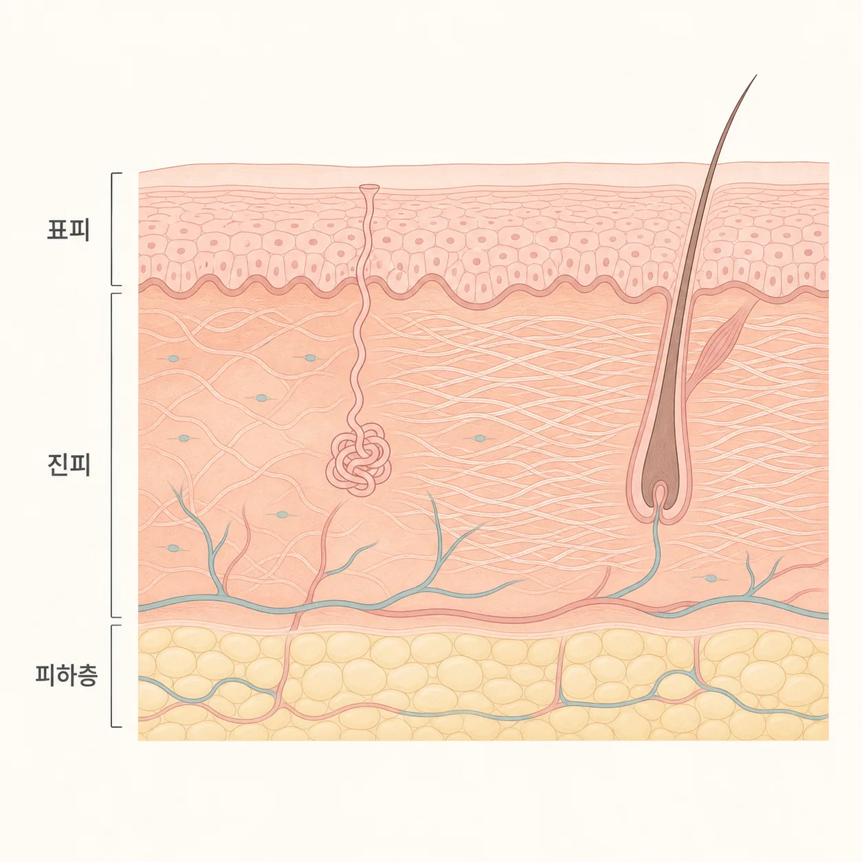 진피층에서 다시 짜이는 콜라겐 섬유의 그물망