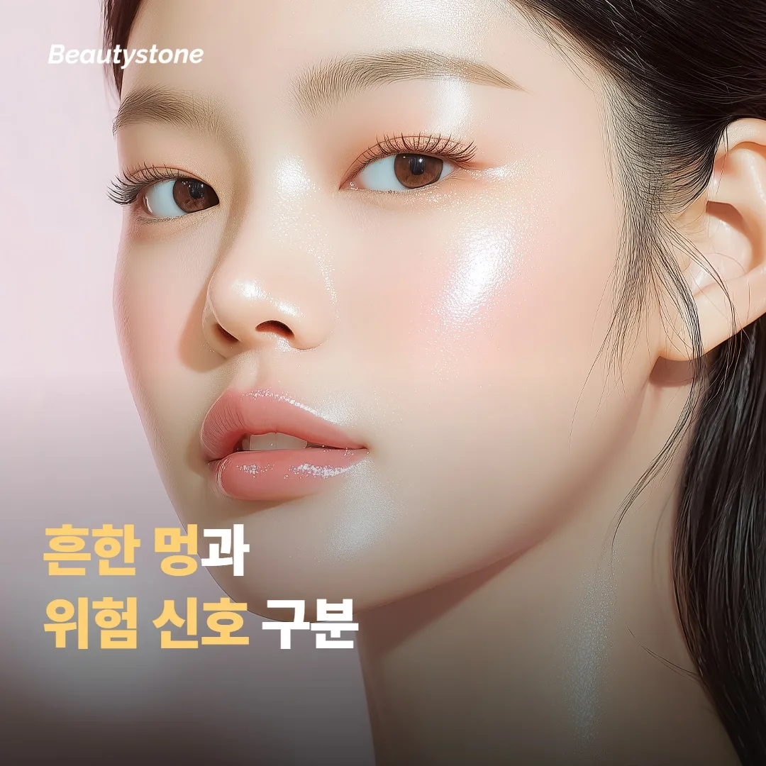 흔한 멍과 병원에 연락할 신호 구분하기