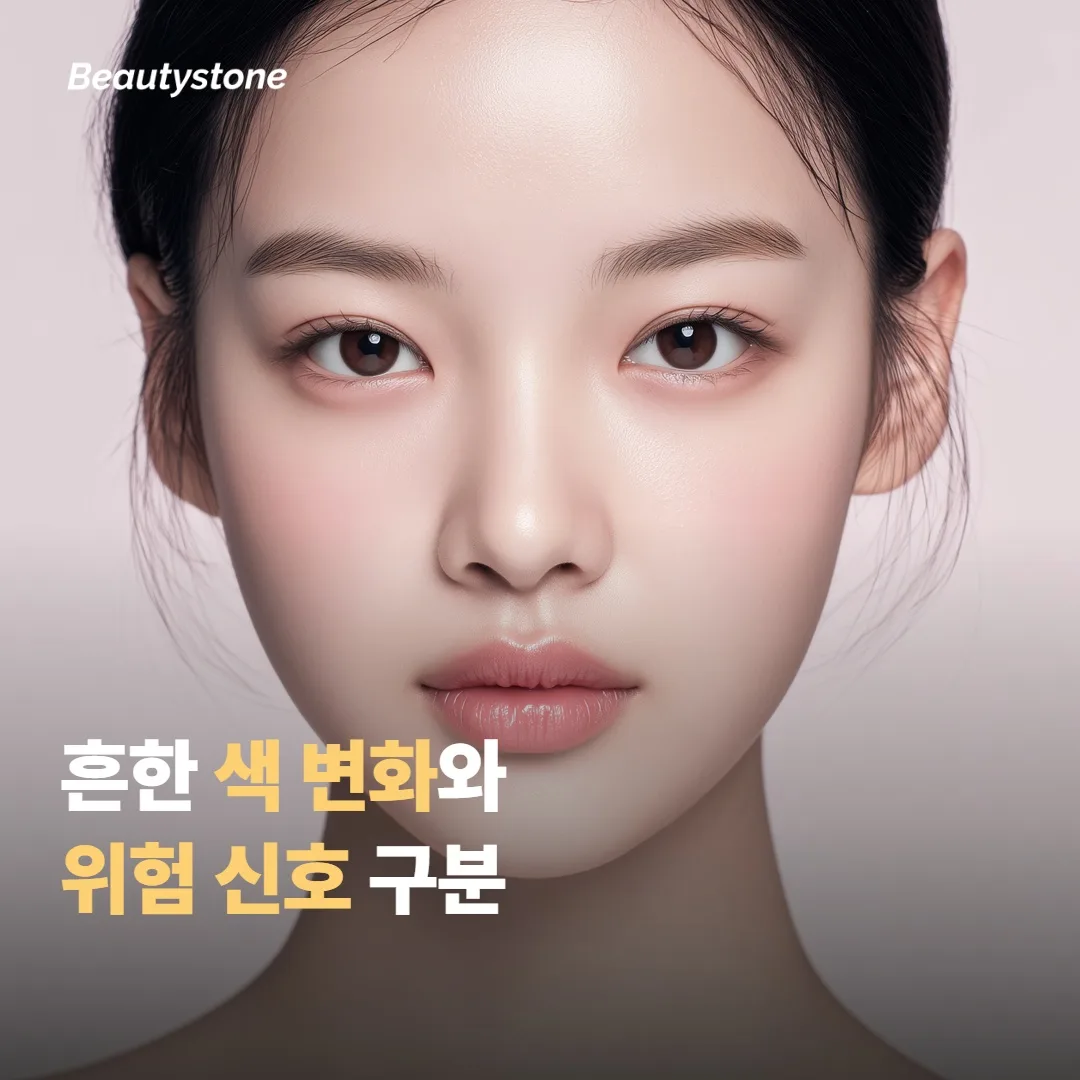 흔한 색 변화와 병원에 연락할 신호 구분하기