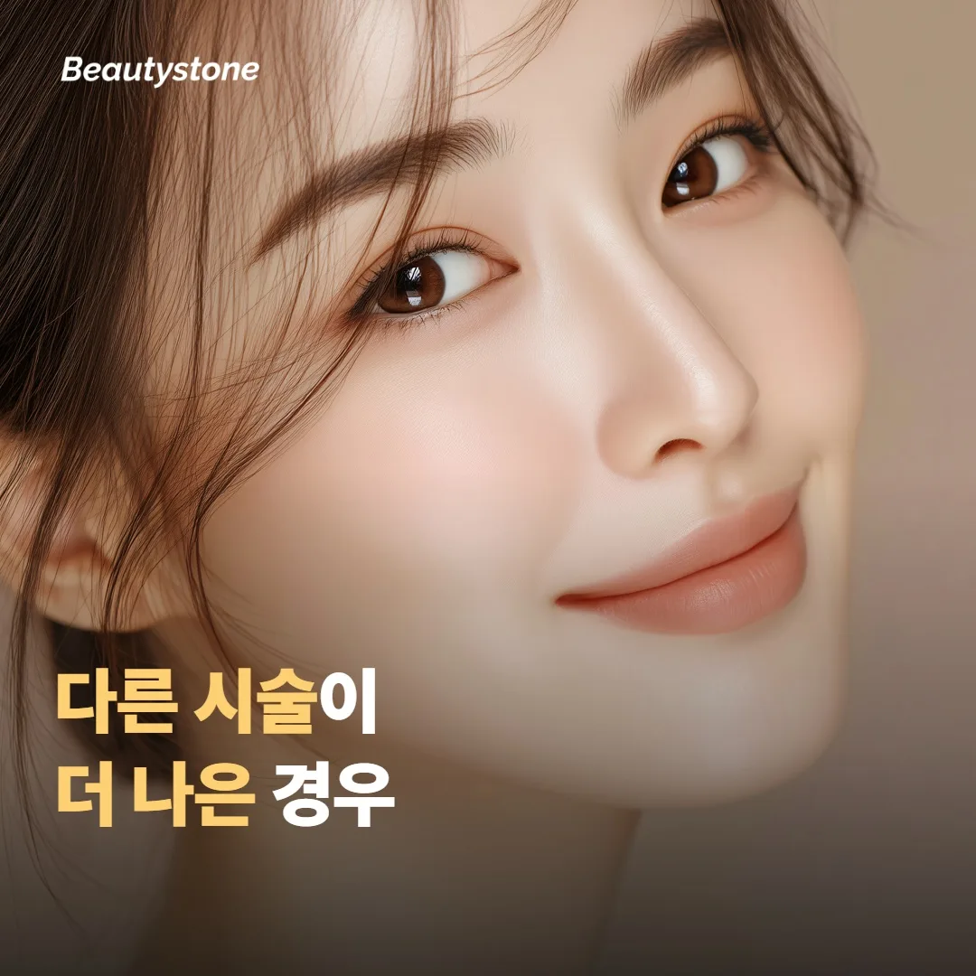 이런 경우엔 다른 시술이 더 나아요