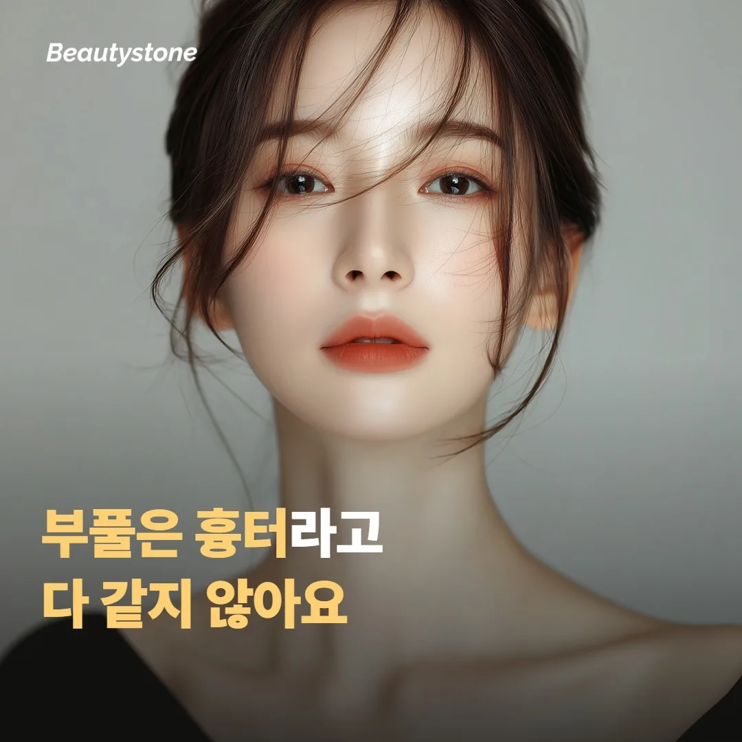 켈로이드와 비대성 흉터는 무엇이 다를까요
