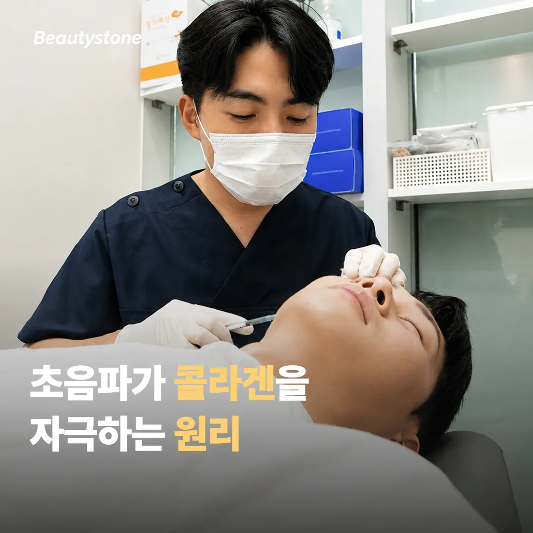 초음파 리프팅이 이마·눈썹에 작용하는 원리