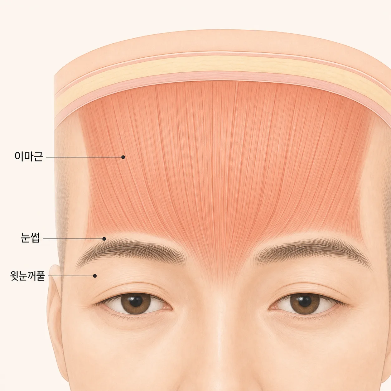 이마근과 눈썹, 무거워지는 윗눈꺼풀의 위치 관계