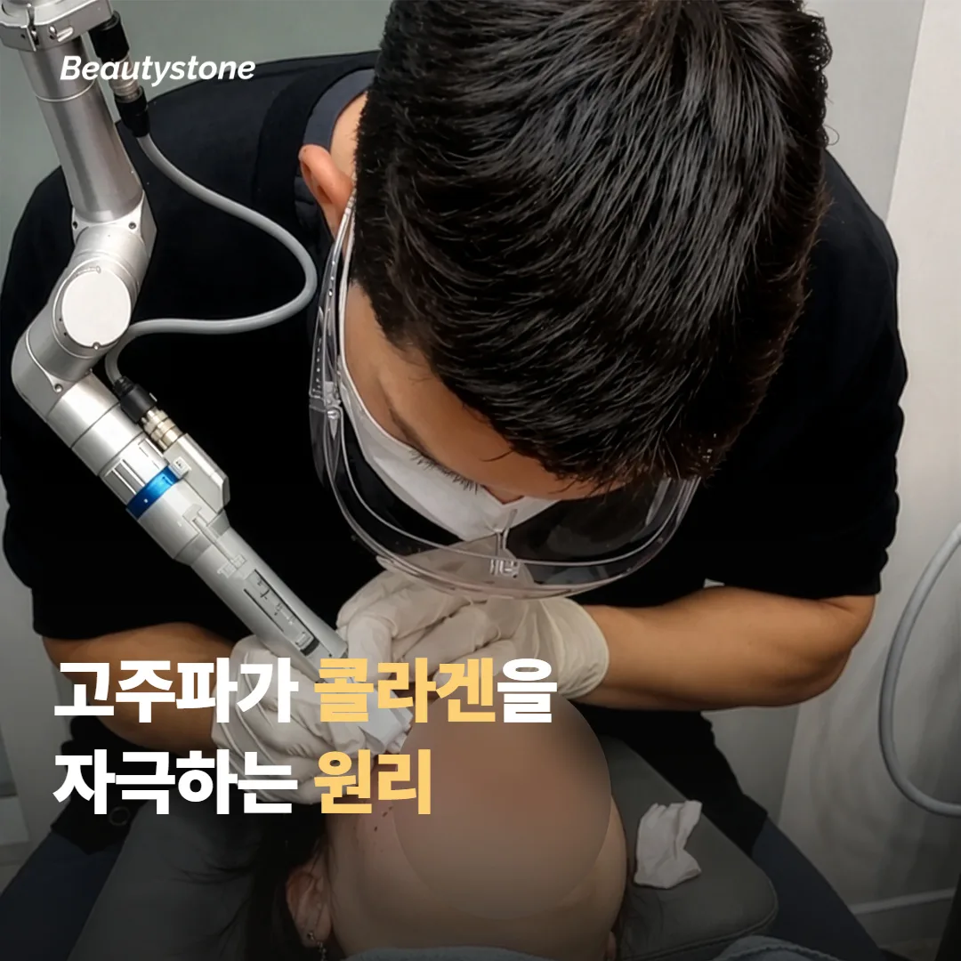 고주파 리프팅이 목 피부에 작용하는 원리