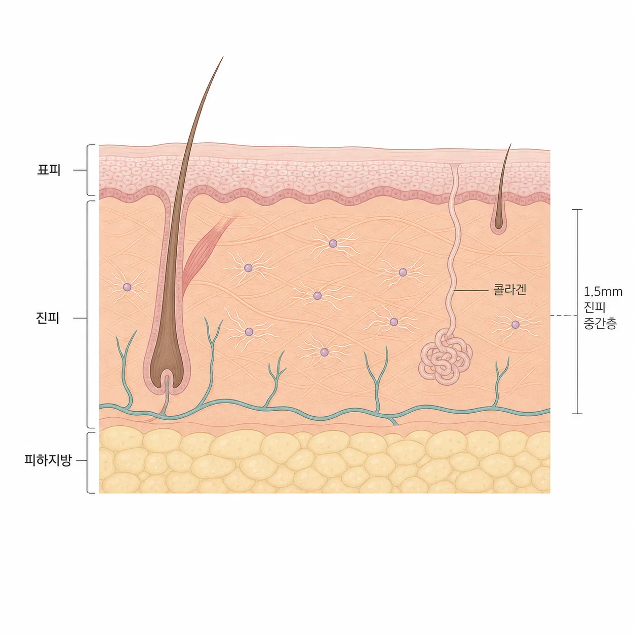 진피 안에서 콜라겐이 새로 차오르는 층 구조