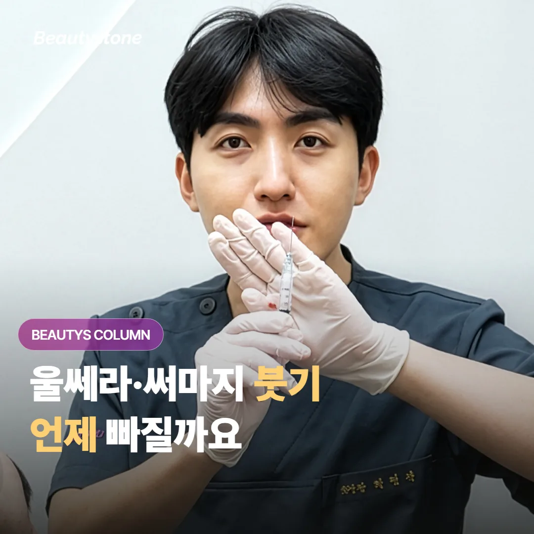울쎄라·써마지 받고 붓기가 언제 빠지는지, 직후·1주·2주로 나눠 알 수 있을까요?