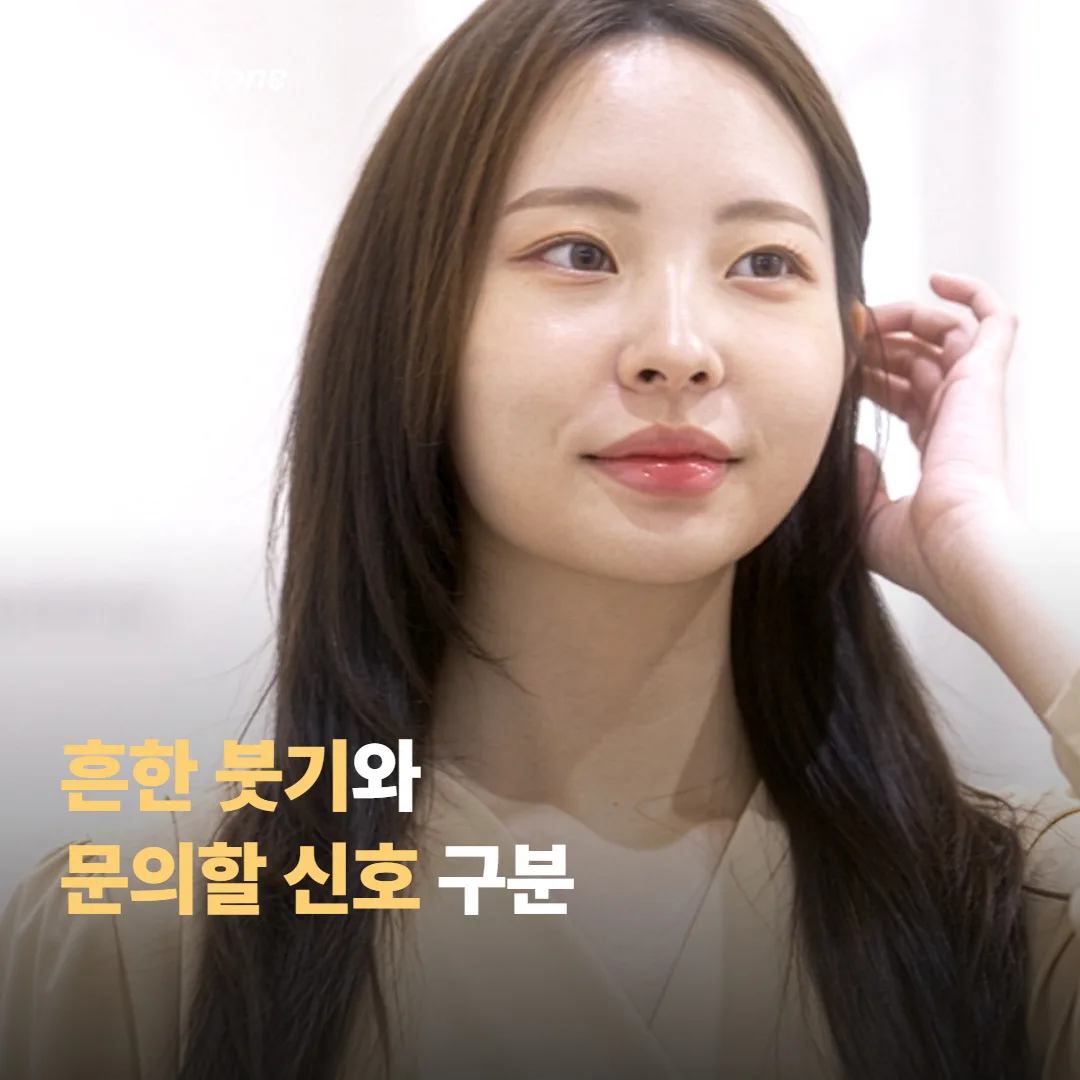 흔한 붓기와 의료진에게 문의할 신호 구분하기