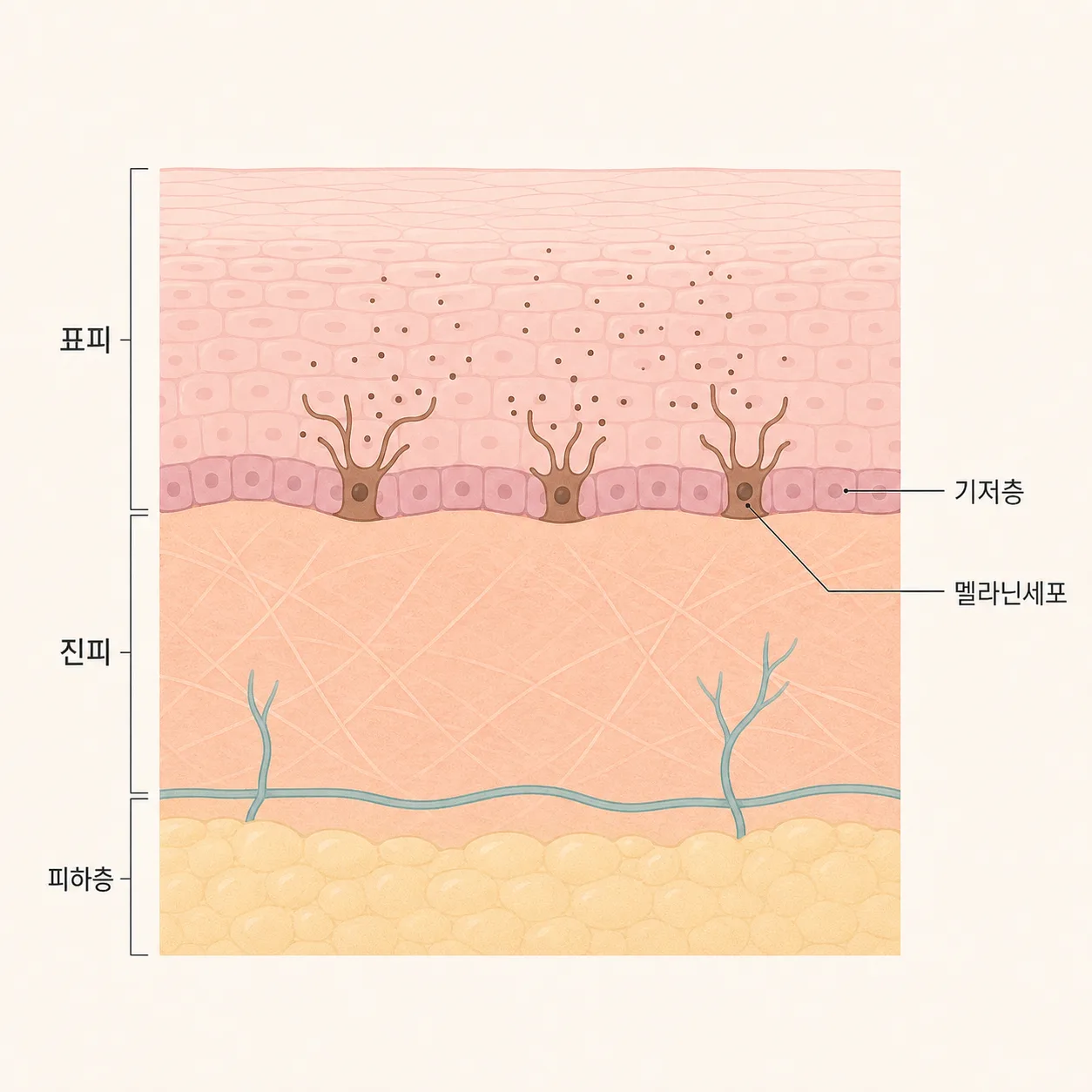 표피 기저층의 멜라닌세포와 멜라닌 분산